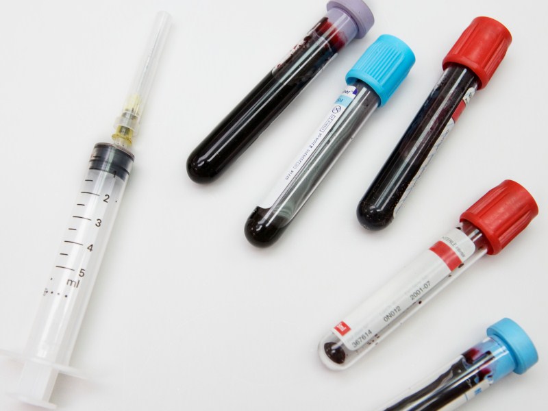 syringe with blood test tubes